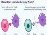 Can Immunotherapy be used to treat Mesothelioma