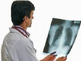 New Legislation in Northern Ireland for Pleural Plaques Compensation