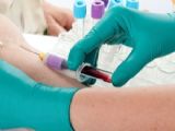 mesothelioma blood tests