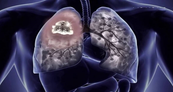 how early can copd be diagnosed